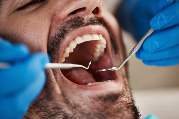 Best Emergency Dental Care for Broken or Chipped Teeth in Ringgold, LA